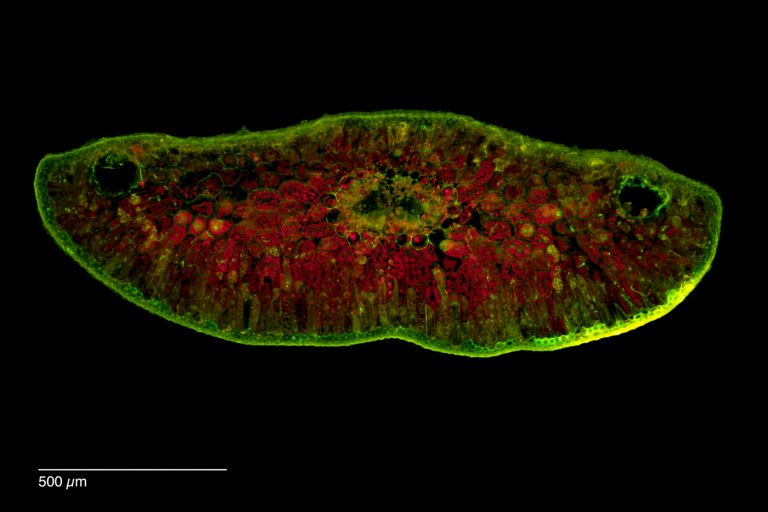 Abies nordmanniana_Nordmann-Tanne_ Nadel_Autofluoreszenz_IB SPA4_img_241216_006 Abies nordmanniana_Nordmann-Tanne_ Nadel_Autofluoreszenz_IB SPA4_img_241216_006