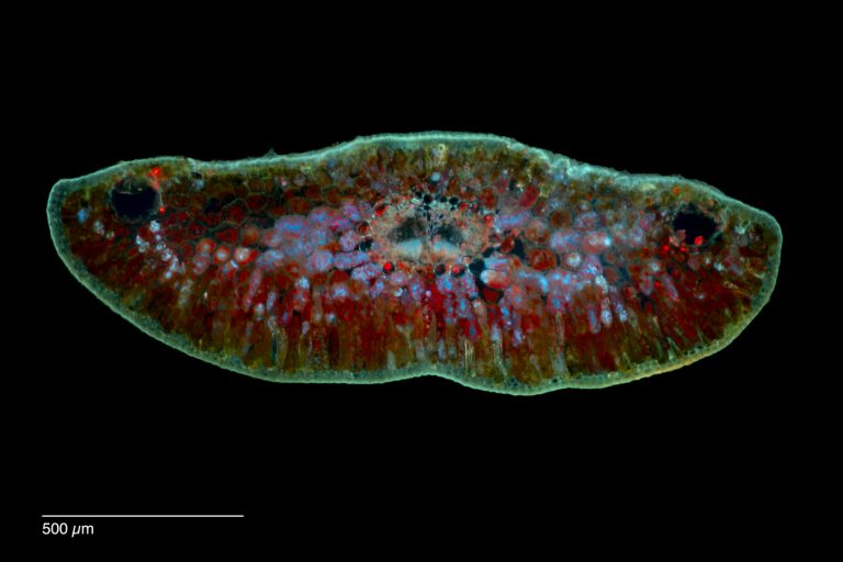 Abies nordmanniana_Nordmanntanne_Nadel_Autofluor_V_SPA4_img_241216_007 Abies nordmanniana_Nordmanntanne_Nadel_Autofluor_V_SPA4_img_241216_007