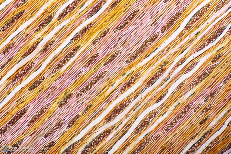 Ahorn - Acer sp. . Tangentialschnitt Ahorn - Acer sp. . Tangentialschnitt