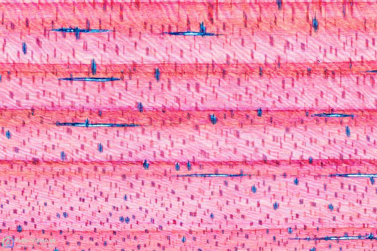 Aleppo-Kiefer - Pinus halepensis - Radialschnitt Aleppo-Kiefer - Pinus halepensis - Radialschnitt