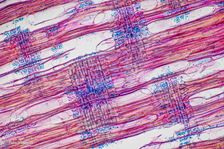 Bergholunder_radial_FCA_SPA10x125_BW_1.15mm_492022_Stack_49pics Bergholunder_radial_FCA_SPA10x125_BW_1.15mm_492022_Stack_49pics