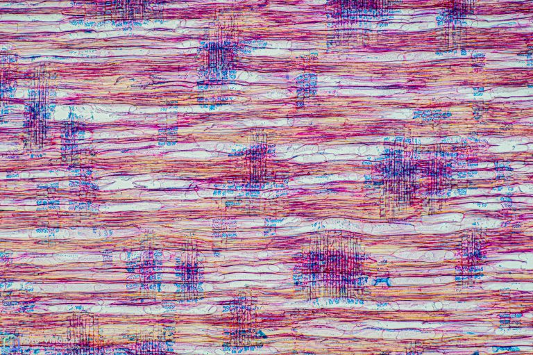 Roter Holunder / Berg-Holunder - Sambucus racemosa - Radialschni Roter Holunder / Berg-Holunder - Sambucus racemosa - Radialschni