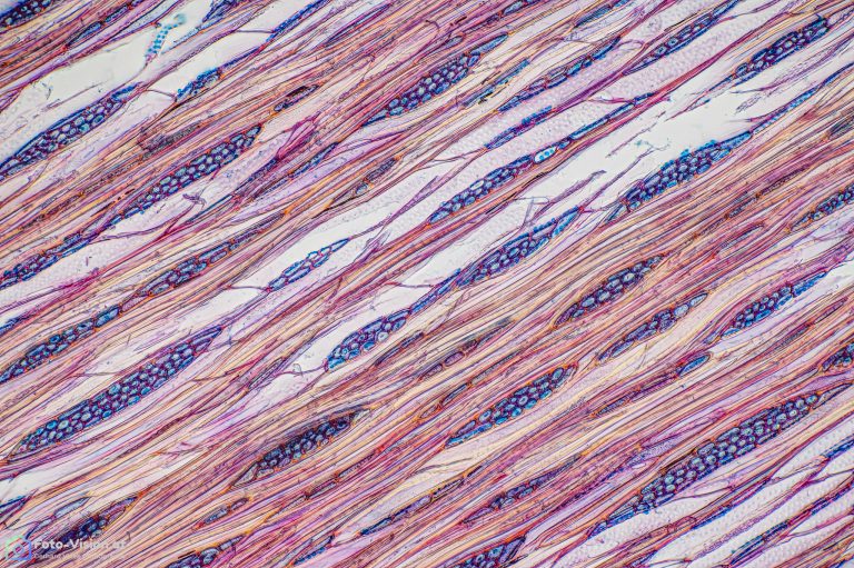 Bergholunder_tang_FCA_SPA10x125_BW_1.15mm_512022_Stack_51pics Bergholunder_tang_FCA_SPA10x125_BW_1.15mm_512022_Stack_51pics