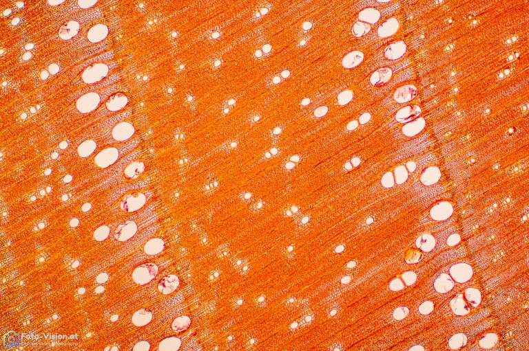 Esche_quer_Acridinrot Acriflavin Astrablau_SPA2FL_img_240108_001-2 Esche_quer_Acridinrot Acriflavin Astrablau_SPA2FL_img_240108_001-2