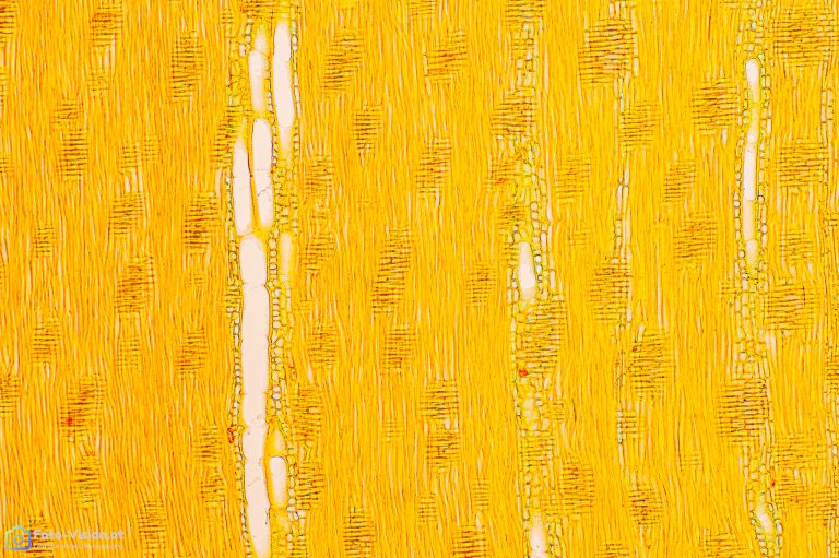 Esche_radial_Acridinrot Acriflavin Astrablau_SPA4_img_240108_001-2-2 Esche_radial_Acridinrot Acriflavin Astrablau_SPA4_img_240108_001-2-2