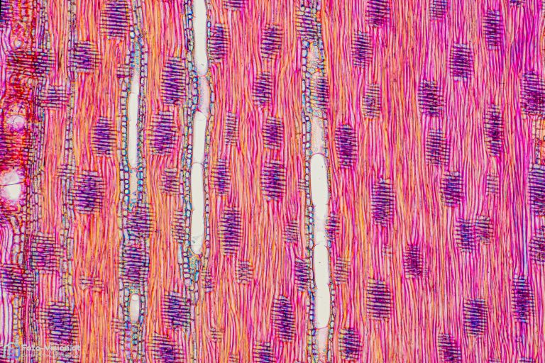 Esche - Fraxinus excelsior - Radialschnitt - FCA - Objektiv SPA4 Esche - Fraxinus excelsior - Radialschnitt - FCA - Objektiv SPA4