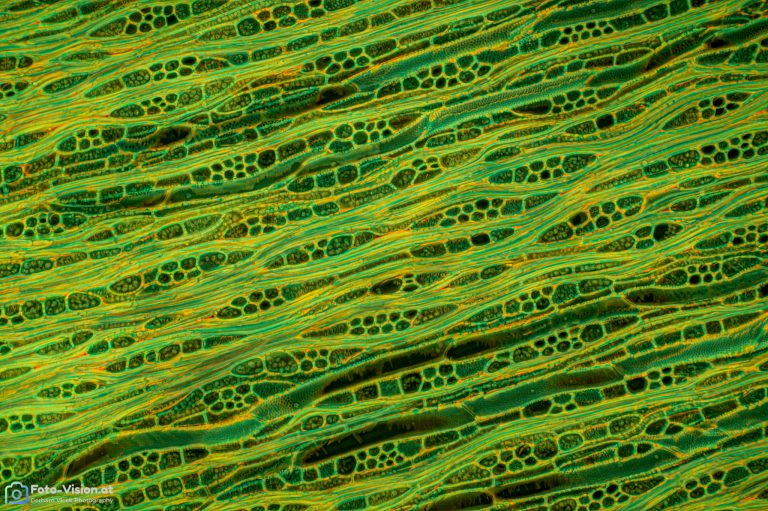 Olive_laengs_W3A_SPA10x125_BW_1.152mm_FluorV-362023_Stack_36pics Olive_laengs_W3A_SPA10x125_BW_1.152mm_FluorV-362023_Stack_36pics