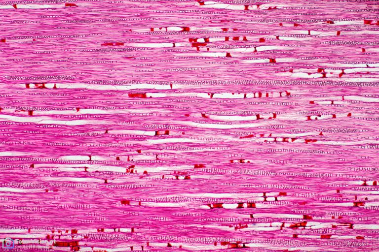 Ringlotte_laengs_AuraminSafranin_SPA4x125-12021-11-24 20-03-43 (C,Smoothing4)19-piccure Ringlotte_laengs_AuraminSafranin_SPA4x125-12021-11-24 20-03-43 (C,Smoothing4)19-piccure