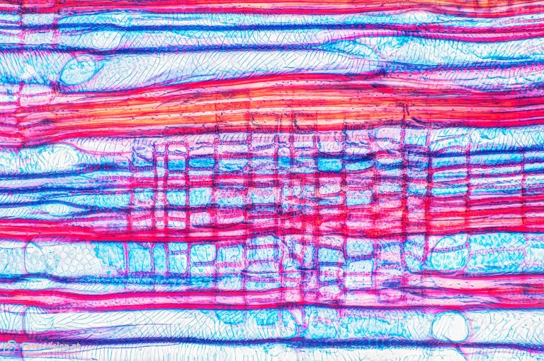 Sommerflieder - Buddleja sp. - Radialschnitt - FCA - SPA10 - Stack 21 Bilder Sommerflieder - Buddleja sp. - Radialschnitt - FCA - SPA10 - Stack 21 Bilder
